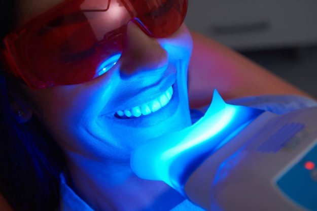 teeth whitening
