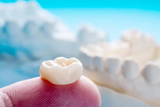benefits of dental crowns