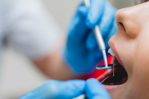 patient getting dental cavity filling