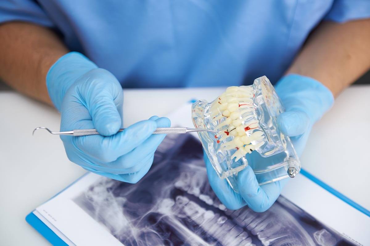 dentist with model answering question do i need a root canal