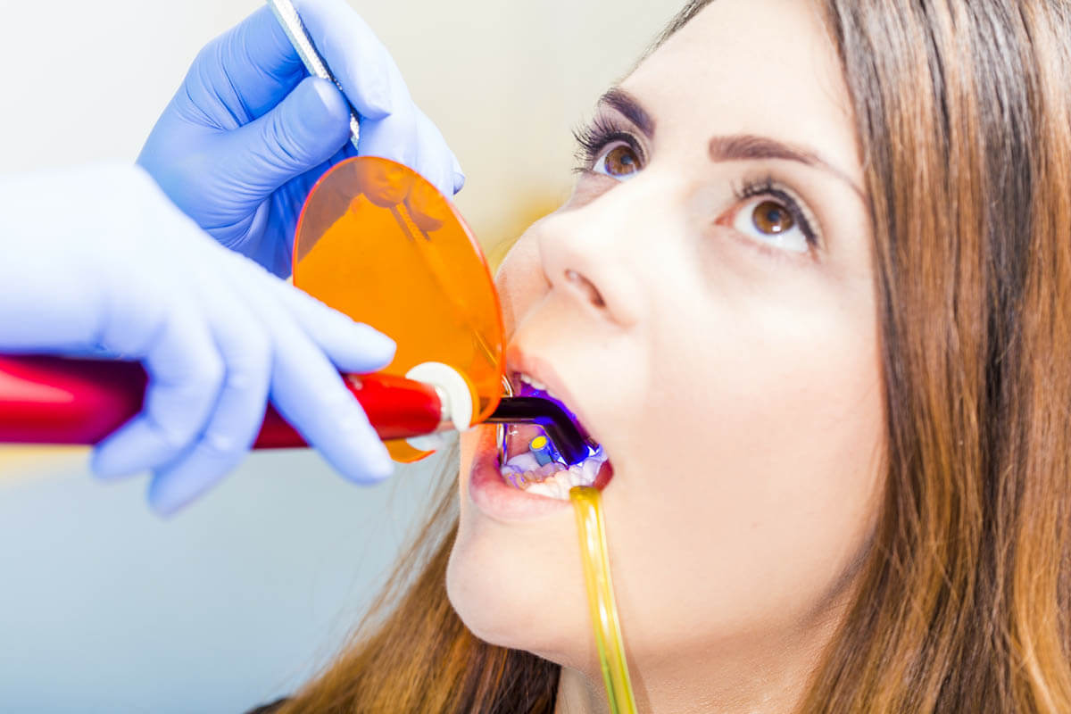 5 Benefits of Dental Bonding dental patient discovering the benefits of dental bonding