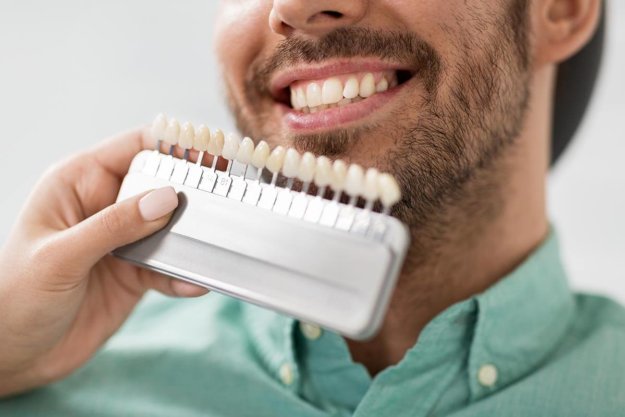 dentist finding right shade of veneers for patient