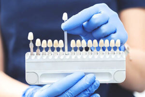 dentist holding up veneers which is an example of a cosmetic dentistry services