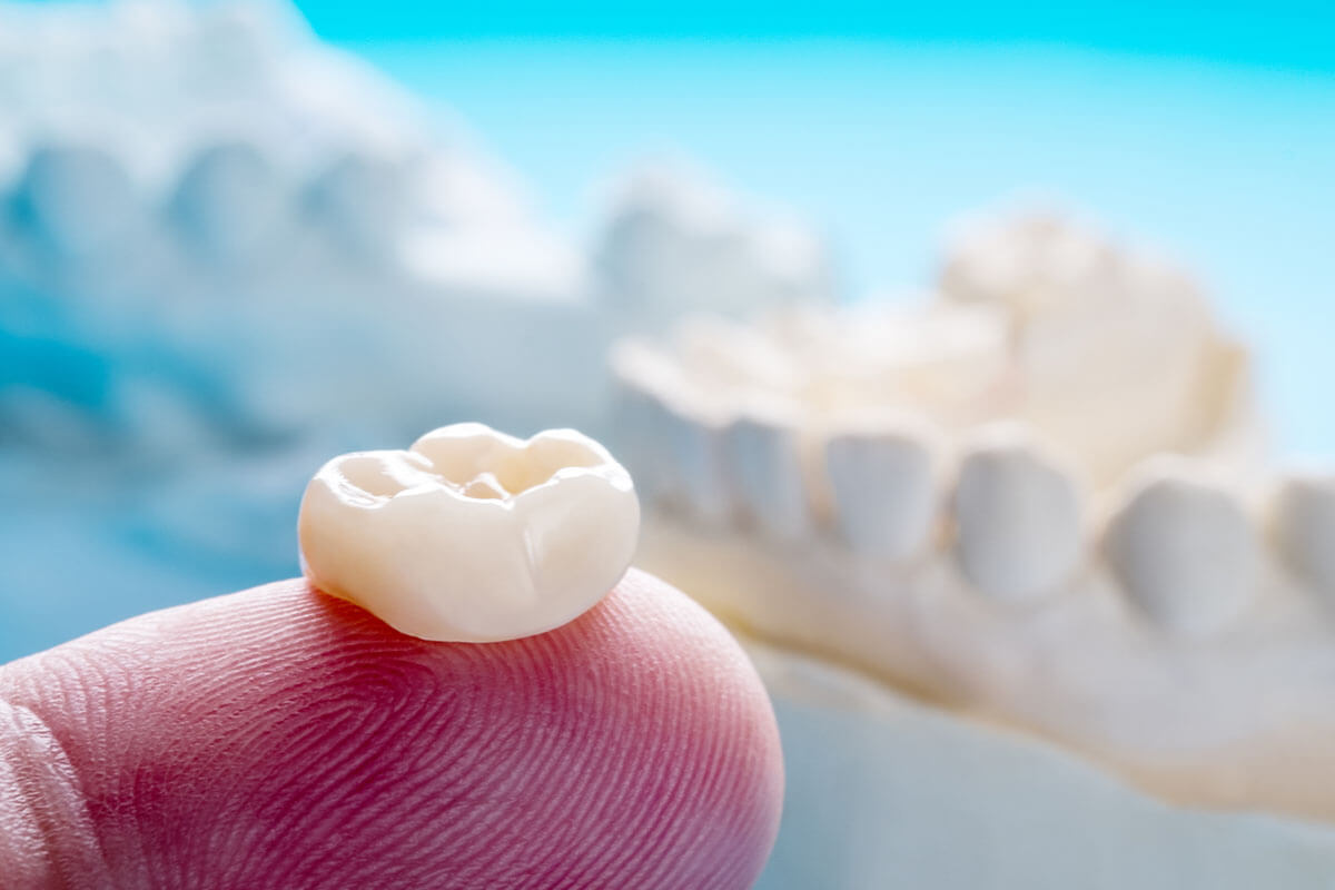 a photo of a dental crown on the tip of someone's fingertip trying to explain the differences between dental crowns vs veneers