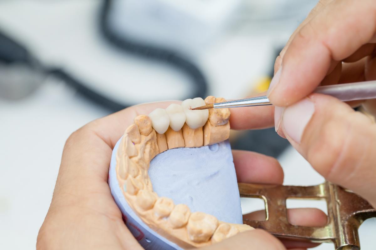 a dental professional holds a mouth model while thinking about the right dental crown material