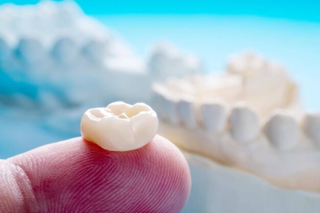 a crown sits on a dentists finger as the dentist explains to the patient about the differences between veneers vs crowns