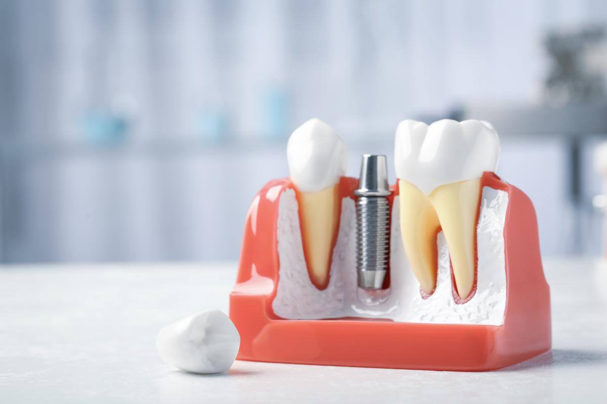 What Is a Prosthodontist? | Dentures in Houston, Texas