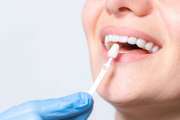 a dental professional holds up a veneer shade to a patients teeth as patient asks do veneers cause bad breath