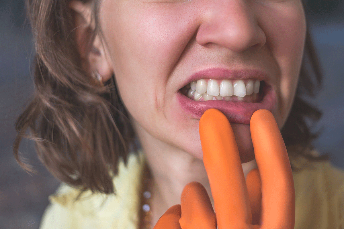 Misaligned-and-Crooked-Teeth-Causes-and-Fixes woman wearing a glove holds onto her bottom lip and shows her crooked teeth