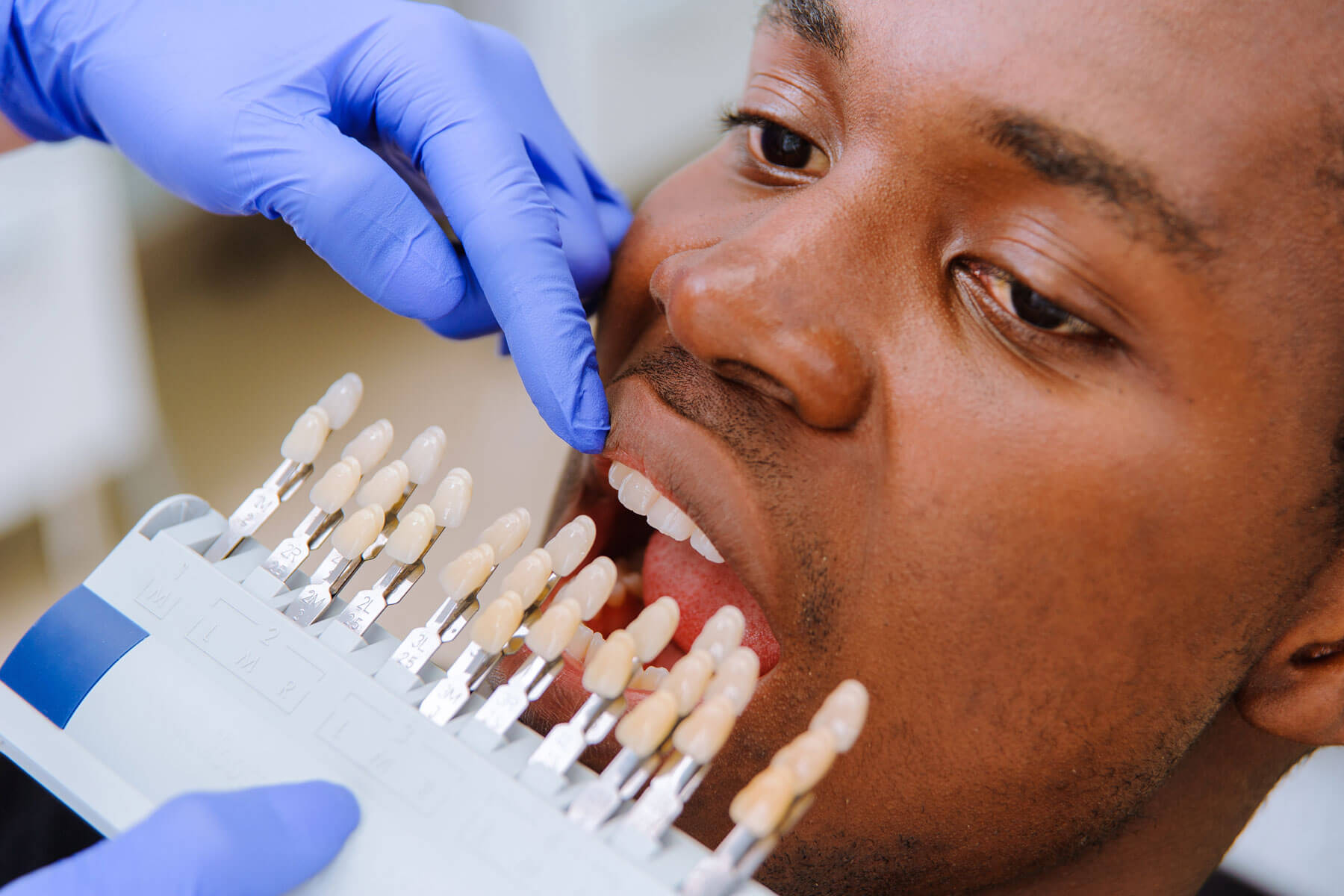 a dental professional holds up veneer shades to a patients mouth as he asks what to expect from the cosmetic dentistry cost