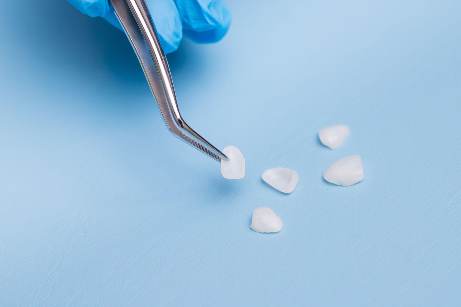 a dental professional is preparing for dental bonding after answering a patient's question about what is dental bonding