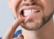 a man points to healthy gums
