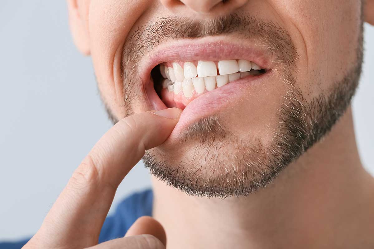 a man points to healthy gums