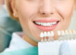 a dental professional holds tooth shade colors next to patient who is undergoing teeth whitening treatment